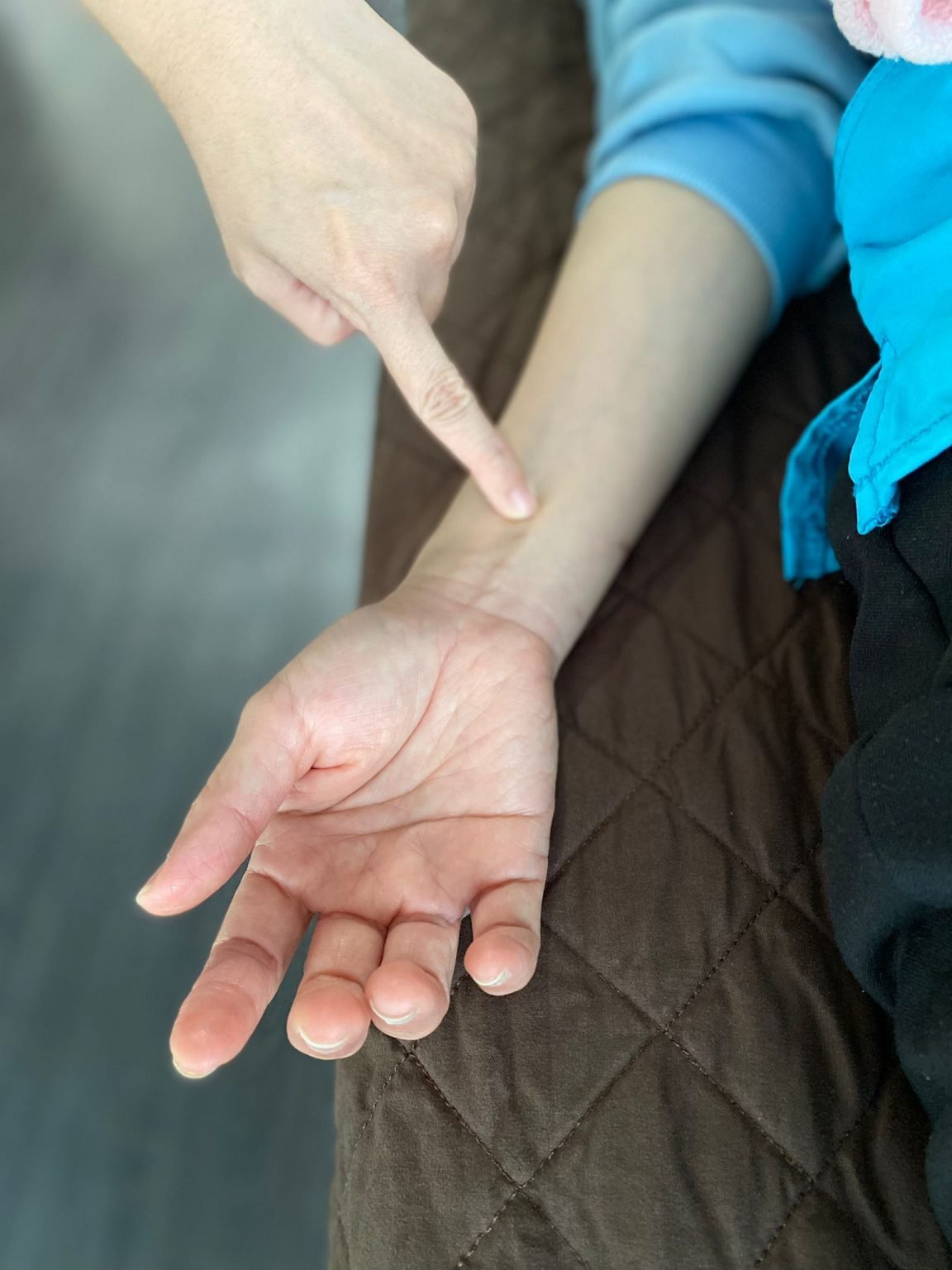 OYGH series GERD with TCM EMW TCM