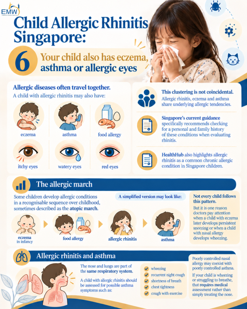 Your child also has eczema, asthma or allergic eyes